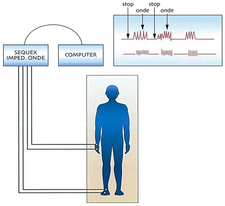 SEQEX Therapy improved Autism symptoms within weeks